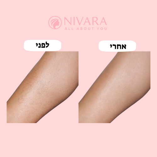 מכונת הגילוח 2 ב־1 של NIVARA – גילוח ללא כאב