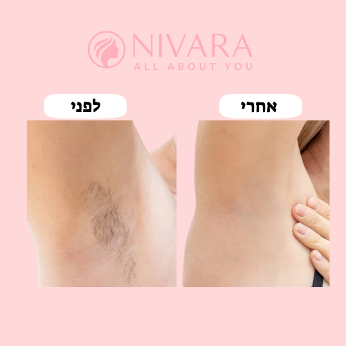 מכונת הגילוח 2 ב־1 של NIVARA – גילוח ללא כאב