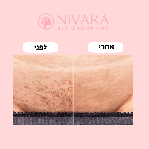 מכונת הגילוח 2 ב־1 של NIVARA – גילוח ללא כאב