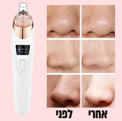 שואב מקצועי לראשים שחורים