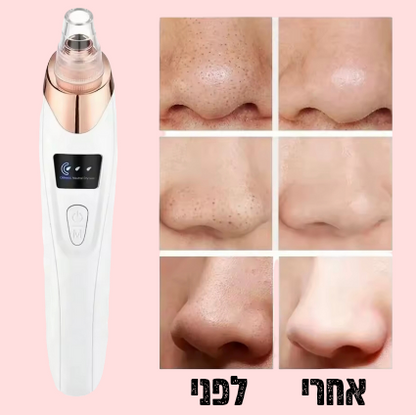 שואב מקצועי לראשים שחורים