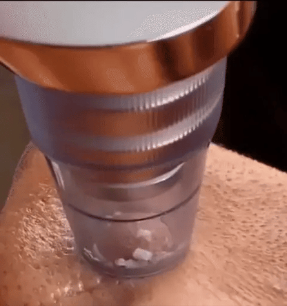 שואב מקצועי לראשים שחורים