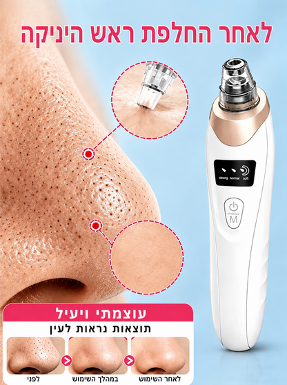 שואב נקודות שחורות מקצועי